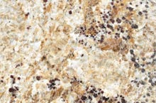 Stones International Colonial Premium