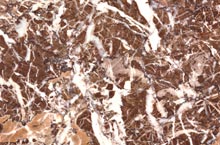 Stones International Breccia S. Agata
